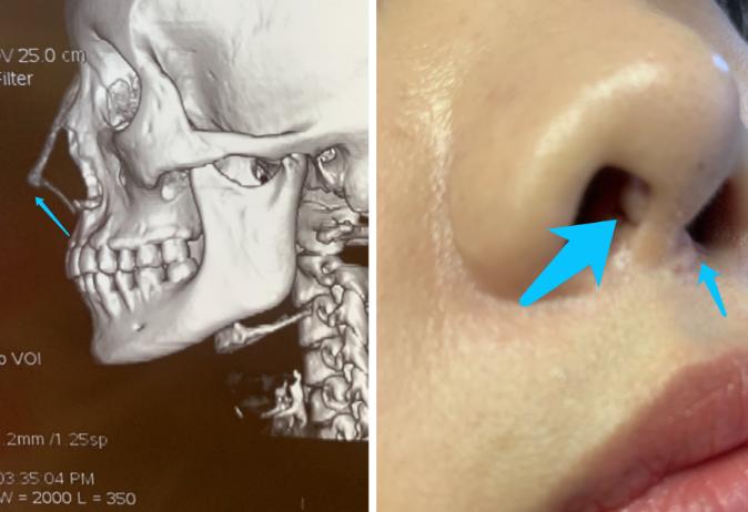 新氧公益与医美,新氧公益救助项目有哪些