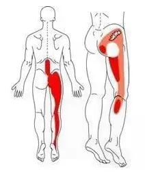 怎么辨别是不是癌引起的腰腿疼,什么癌症会导致腰腿痛