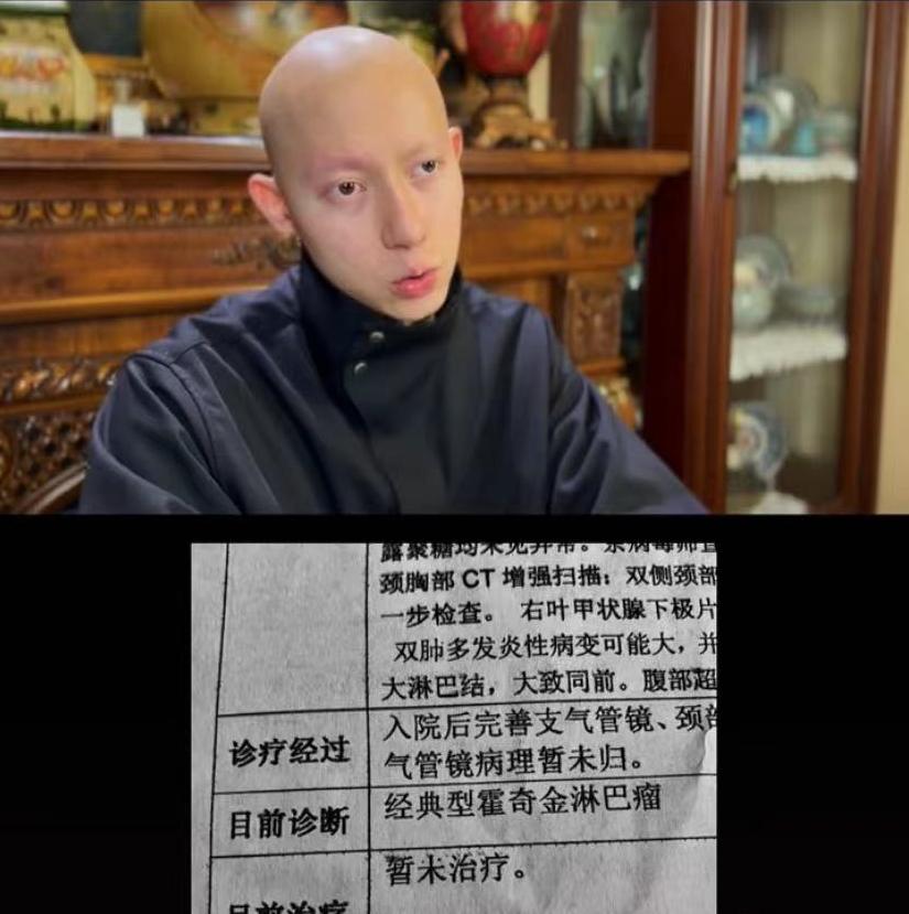 患淋巴癌的网红,男网红消失半年患淋巴癌