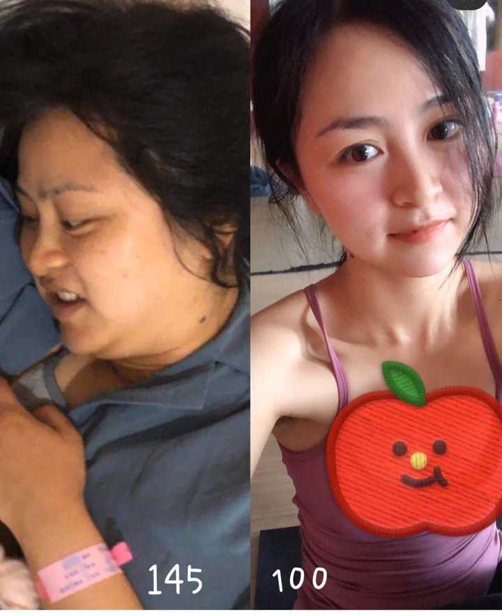 产后宫缩疼痛多久才能恢复,产后下面下坠感多久能恢复