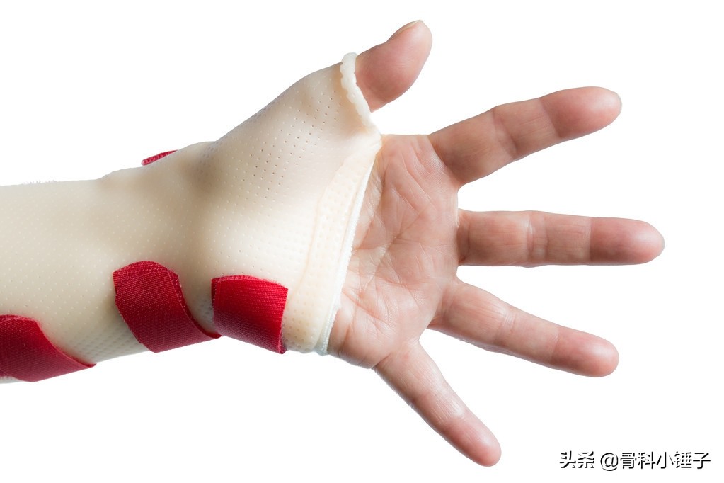 女性腱鞘炎的防治方法,一个动作防止腱鞘炎