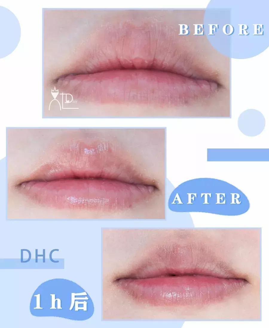 拯救沙漠唇秋冬润唇膏大推荐,品牌润唇膏保湿防干裂第一名
