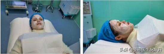 做过的来聊一聊，水光针能打吗？不太敢尝试...