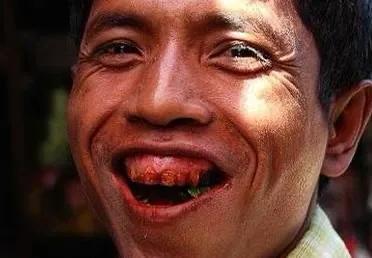 日本吃槟榔的危害,槟榔吃了6年