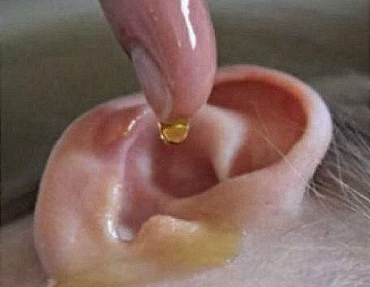 孩子耳朵里进虫子,孩子耳朵进虫子了怎么办