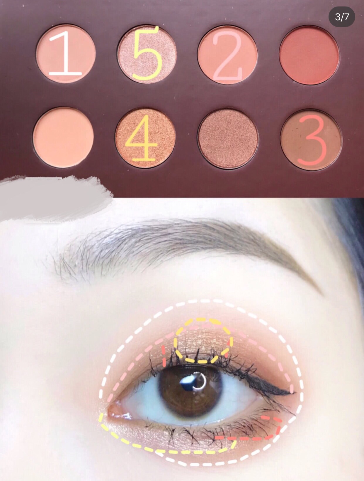 单眼皮浮肿变双眼皮怎么恢复正常,单眼皮眼皮无力怎么改善