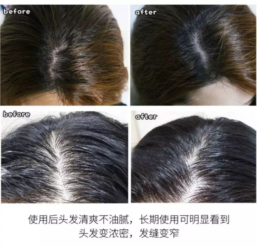 日本蒙琉洗发水,蒙古防掉发洗发水