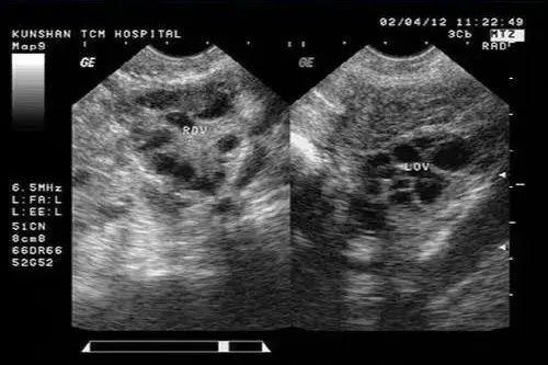 没有妇科病可以妇科检查吗,女性有必要定期做妇科检查吗