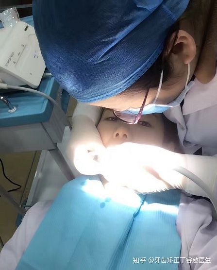 隐适美牙套矫正手法,隐适美牙套矫正的全过程