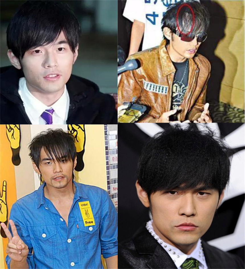 周杰伦黄晓明沙溢吴彦祖聂远,黄晓明周杰伦头发稀疏