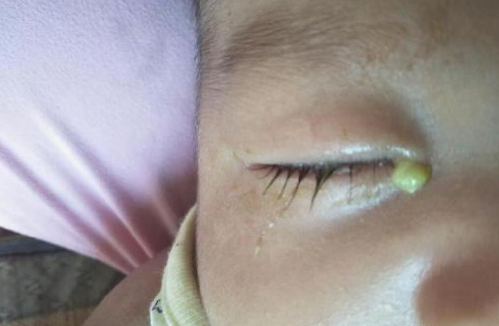 小月子期间月子水有必要喝吗,产后坐月子要多喝水吗