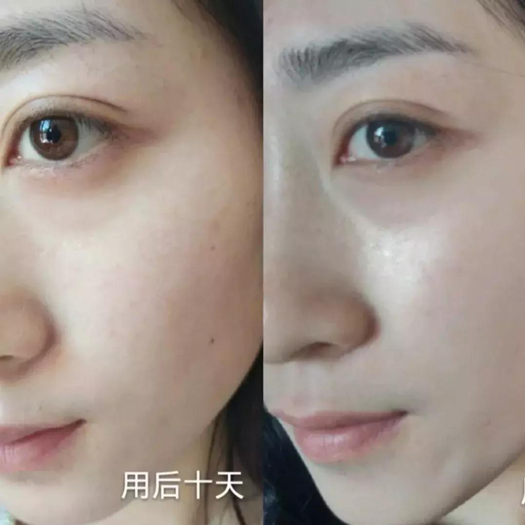 精华原液成分怎么选,精华好用的成分推荐