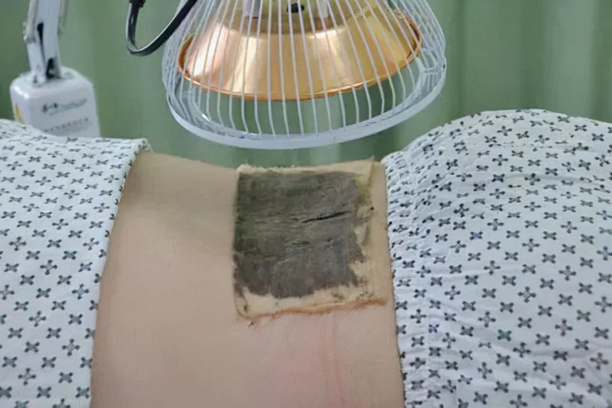 国外治疗膜性肾病,中西医结合治疗肾病的优势