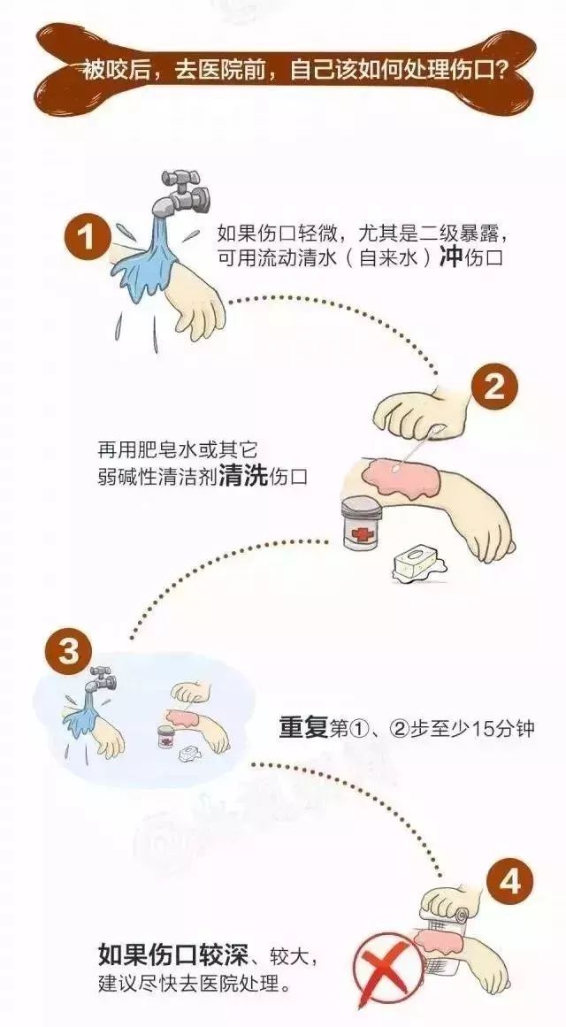 暑假安全隐患多！孩子被狗咬怎么办？除了去医院这3步家长要知道