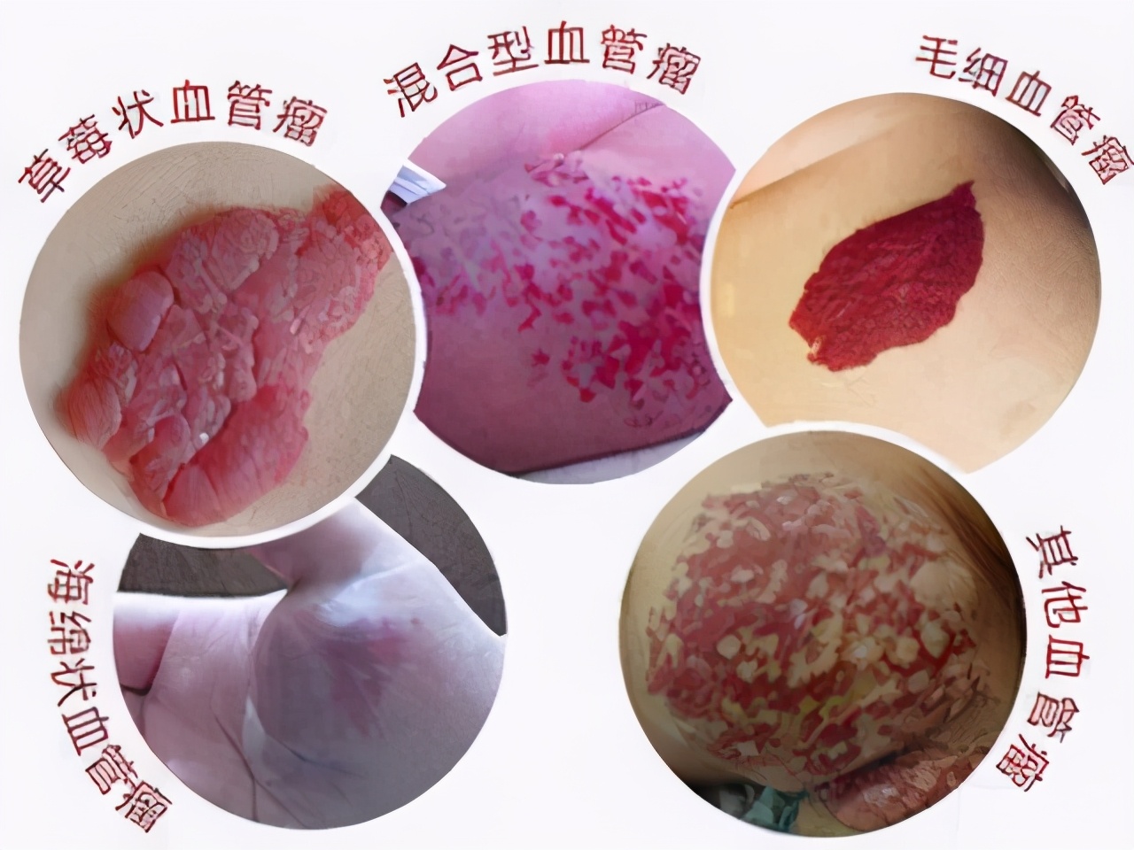 深圳市人民医院黄智勇,人民医院黄智勇