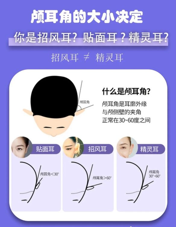 20万玻尿酸,一连打6支玻尿酸会怎么样