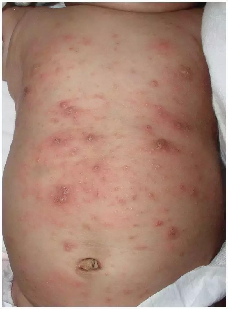 郑州大学科研最新成果,郑州大学进步神速