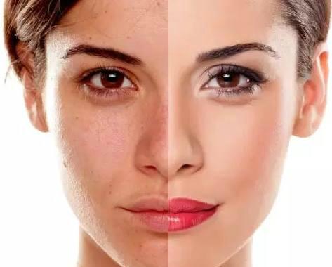 丽皙白好用吗,丽皙白美白淡斑霜