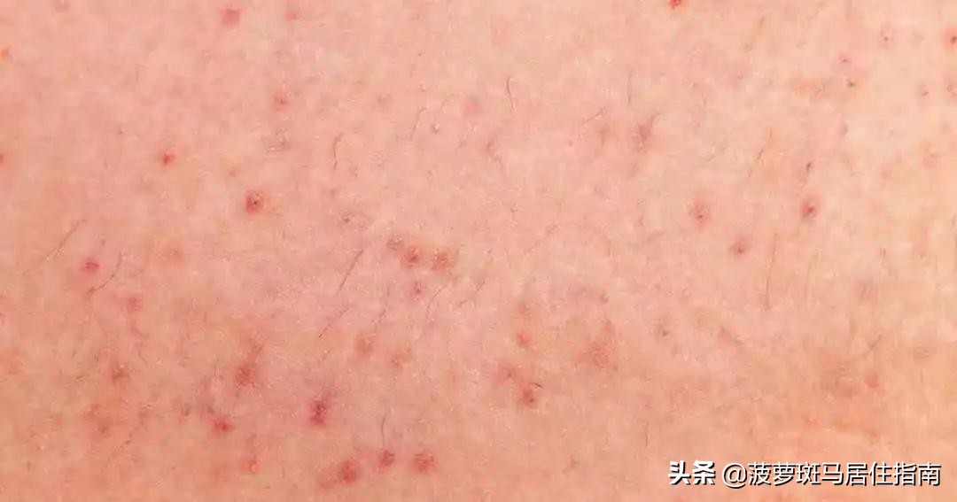 又实用又简单的脱毛办法,脱毛干货