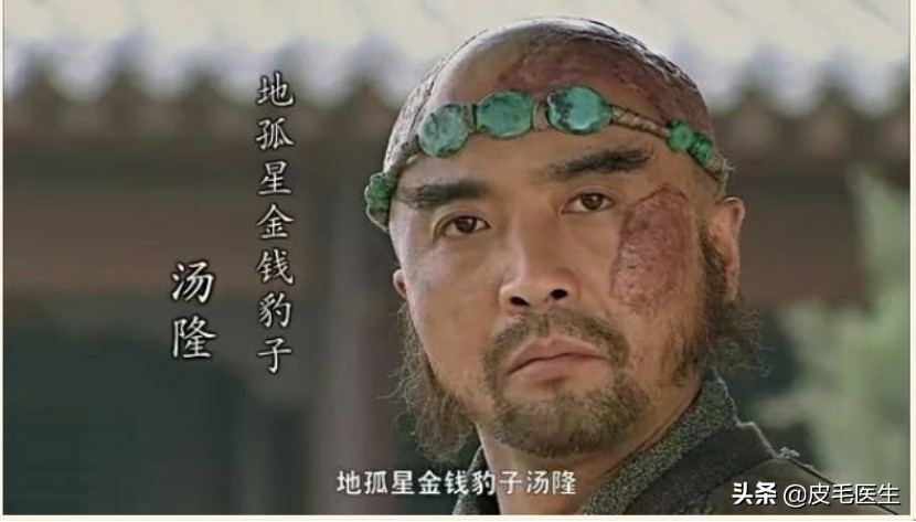 忍不住想给梁山好汉，送一台激光治疗仪