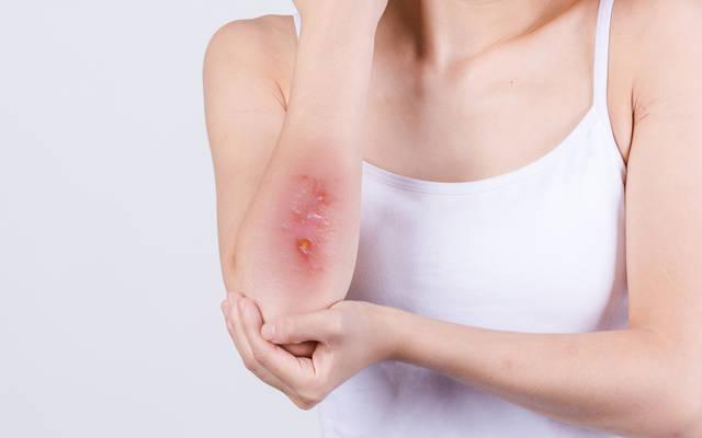 妇科医生给的忠告女人少生气,女性查出hpv需要注意什么