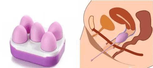 产后修复盆底肌凯格尔运动30分钟,产后盆底肌修复做10次是连续做吗