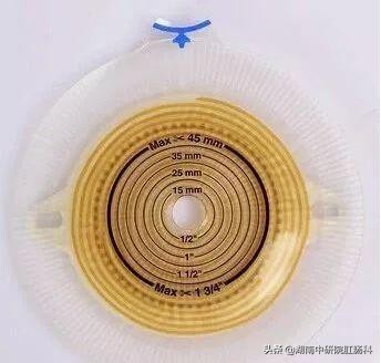 造口患者日常生活护理宣教,造口病人夏季护理