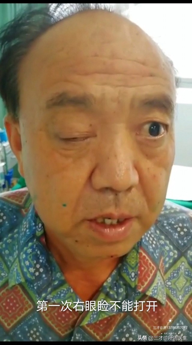 乌龟白眼睛怎么治,眼睛麦粒肿怎么治