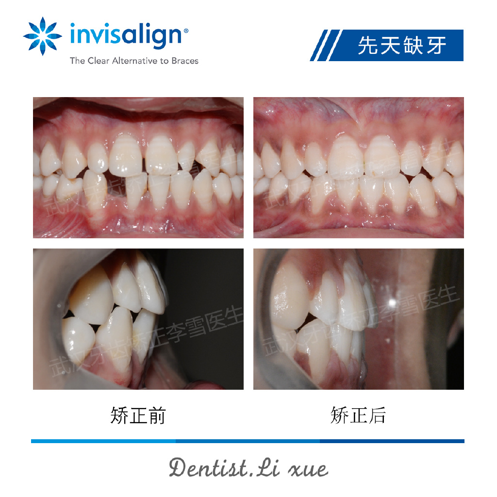 武汉牙齿矫正整形医生,武汉牙齿矫正医生推荐