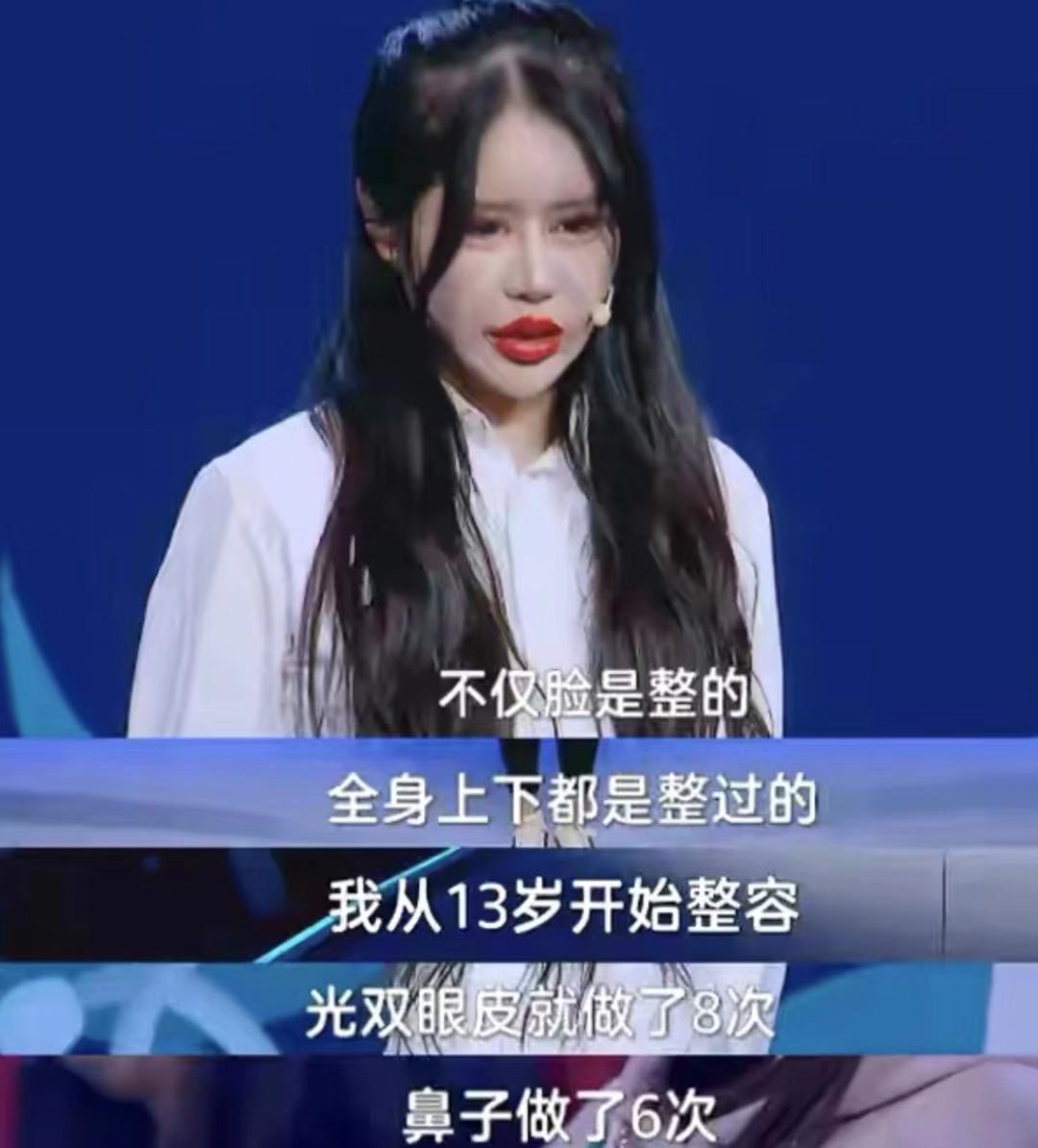 15岁网红自曝整形超100次，后遗症记忆力衰退，换脸停不下来