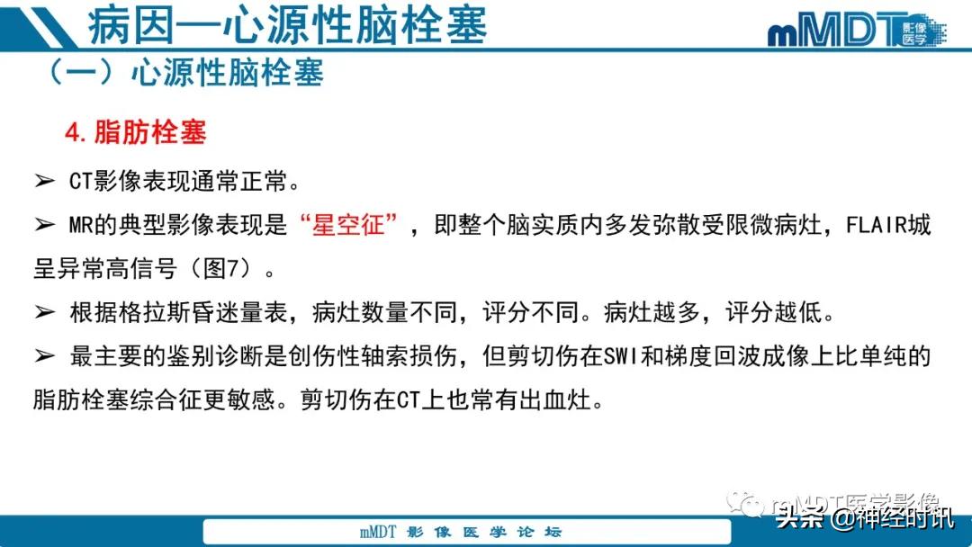 急性缺血性脑卒中ppt素材图片,青年缺血性脑卒中ppt