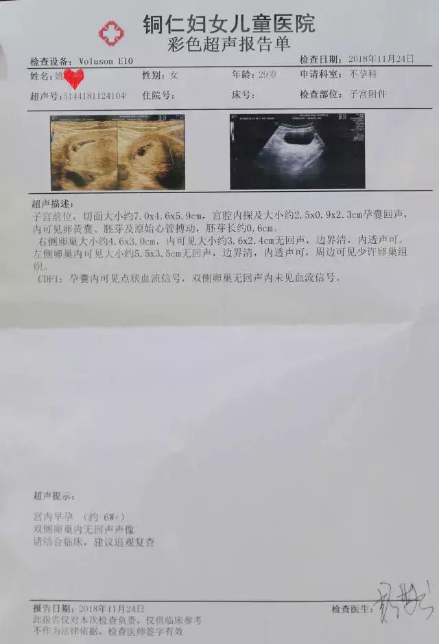 两次宫外孕后如何备孕成功,两次宫外孕后自然怀孕成功案例