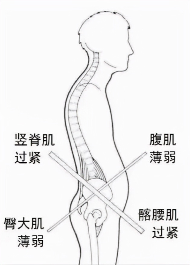 床上放一个枕头好不好,放个枕头在腰部有什么作用
