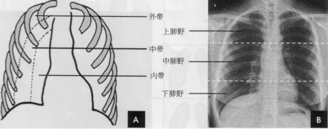 详细的胸部X线解剖，最基础最实用！