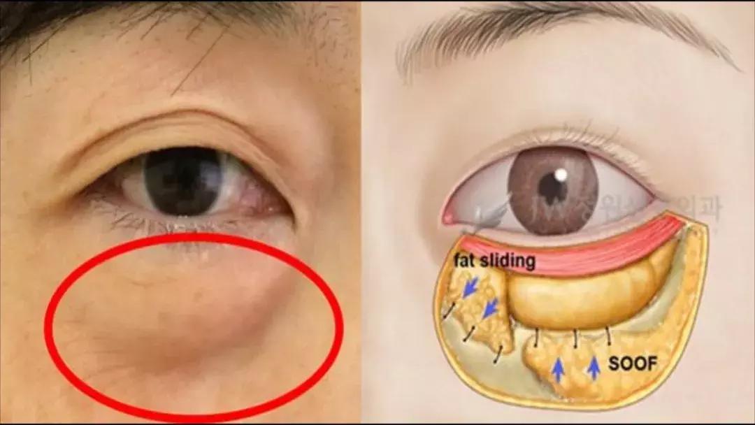 眼霜如何挑选先来看看这篇干货,眼霜排名十大公认好用的眼霜测评