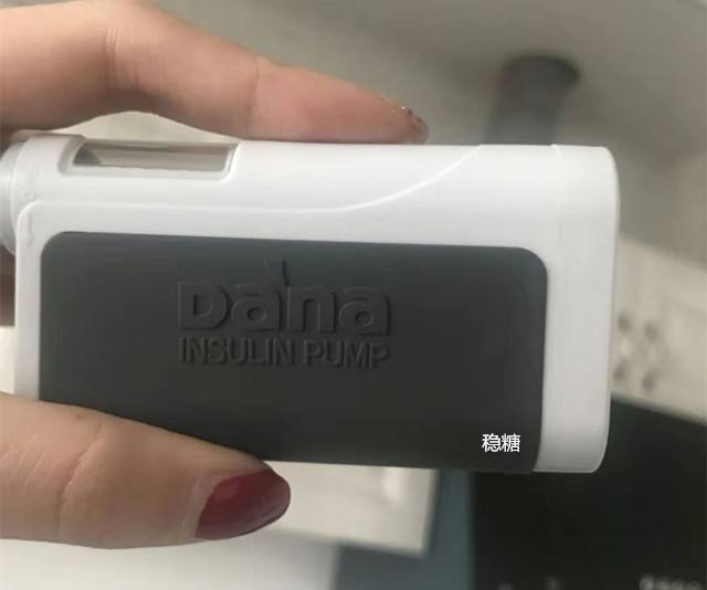 美敦力胰岛素泵711722对比,美敦力胰岛素泵722功能介绍