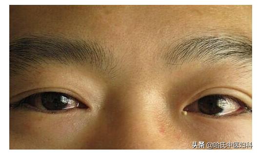 例假时间老不准，不是提前就是延后，什么原因？