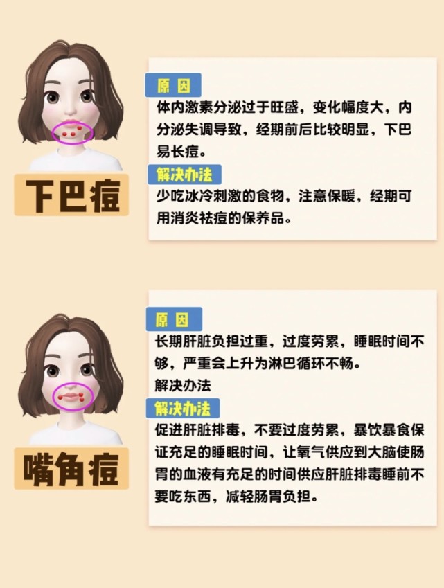 脸部长期爆痘怎么办？超详细的长痘原因剖析！告别痘痘肌