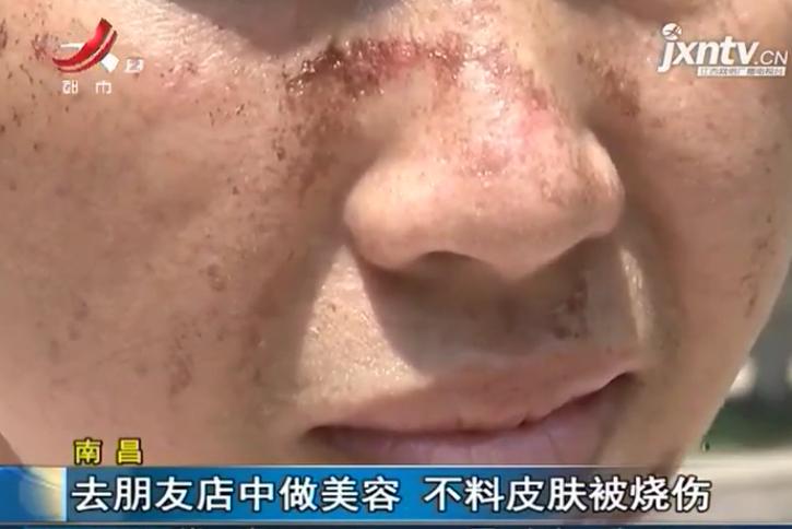 一女子去美容店花1500,女子10年花了30多万美容差点毁容