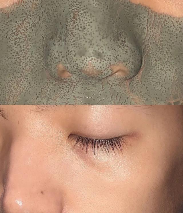 美容院去黑头前敷的东西,美容院去黑头面膜