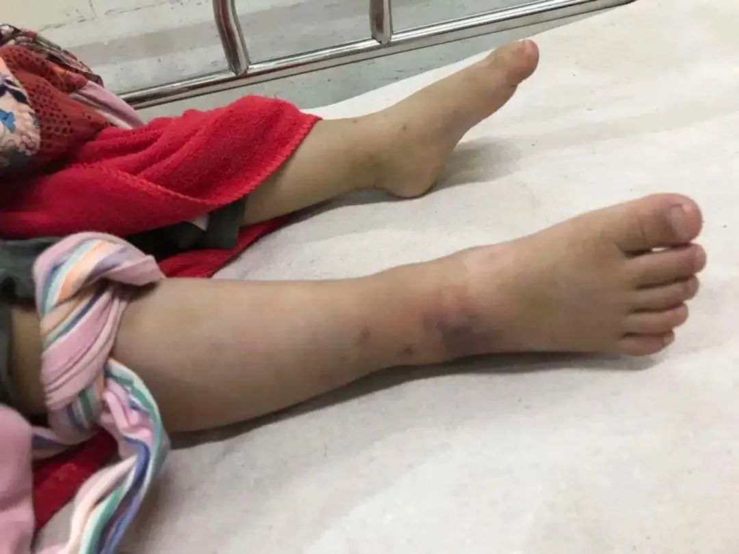 什么蛇最毒咬到了人会怎么样,毒性最强的蛇多久可以致死