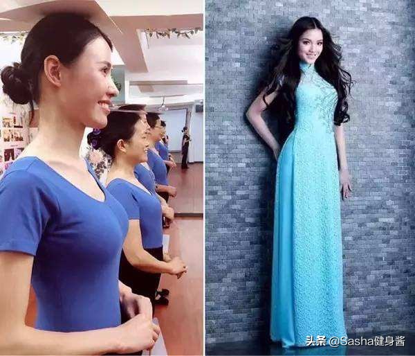 一招改善圆肩驼背头前倾,圆肩驼背矫正最有效方法坐着