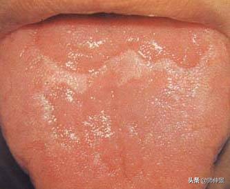 最实用的舌诊图六大舌象,舌诊深入学习书