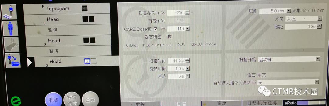 CT影像技术,脑部做ct有伪影是怎么回事