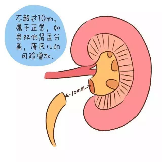 胎儿的大脑发育怎么排查畸形,胎儿有畸形和智力问题能查出来吗