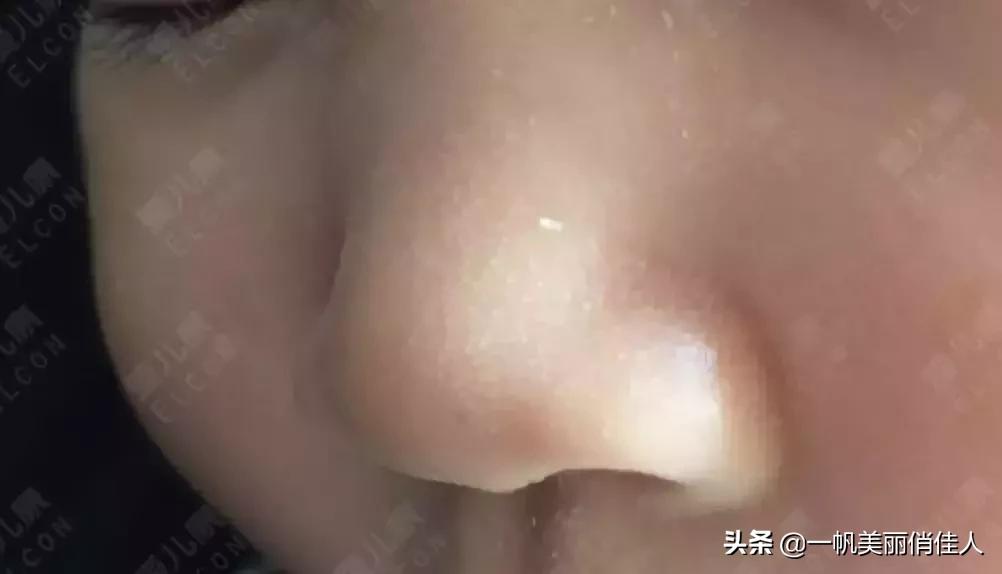 宝宝囟门闭合晚怎么办？过早过晚，都可能有问题…