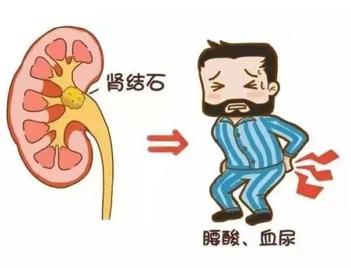 尿液发红是怎么回事正常吗,尿液发红是怎么了