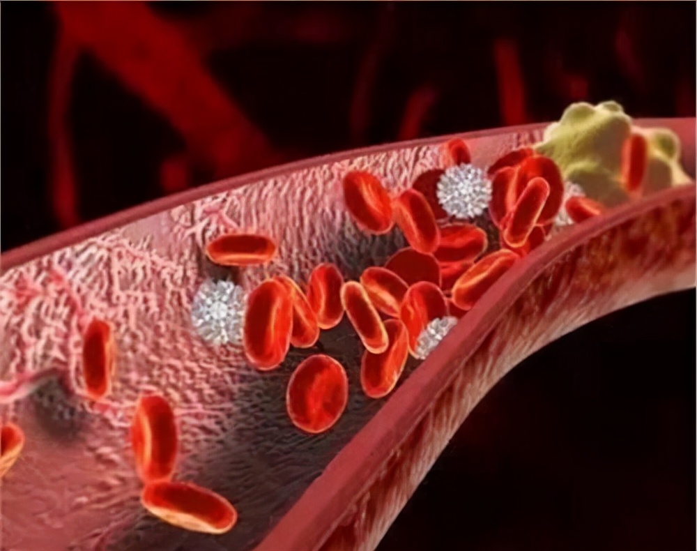 哪几个症状告诉你身体出现了血栓,医生提醒出现五个症状要注意