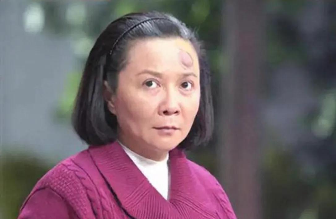 明星整容和不整容老去有什么区别,自然老去和整容明星的对比