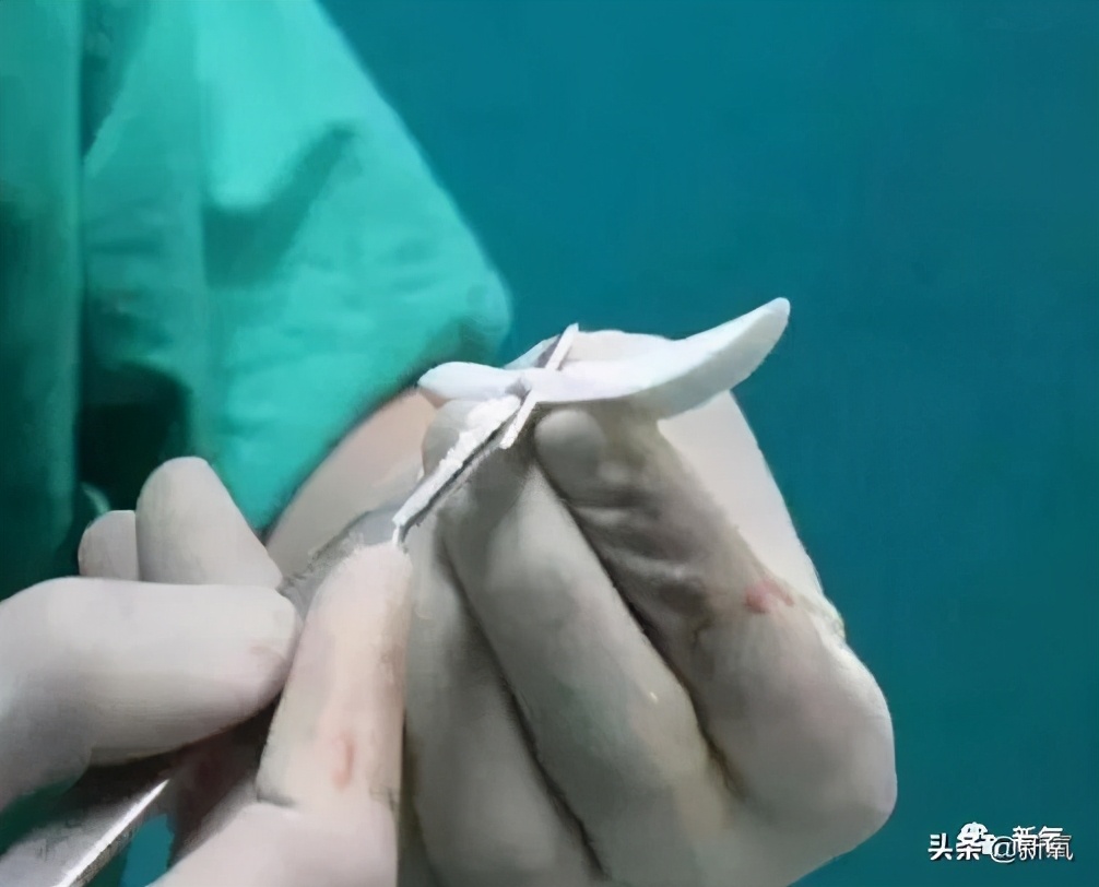 网红整鼻子整出坑,千万网红被坑